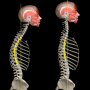 icon Kyphosis & Rounded Back by M&M