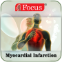 icon Myocardial infarction