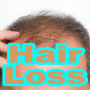 icon Hair Loss