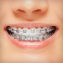 icon Braces